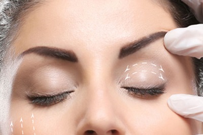 blepharoplastie-laser