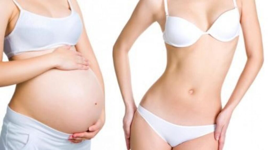 grossesse apres abdominoplastie
