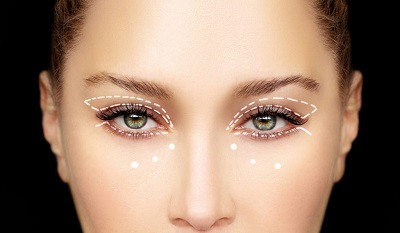 Blepharoplastie-laser-tunisie