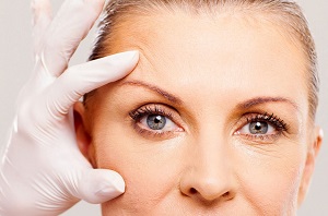 photos blepharoplastie